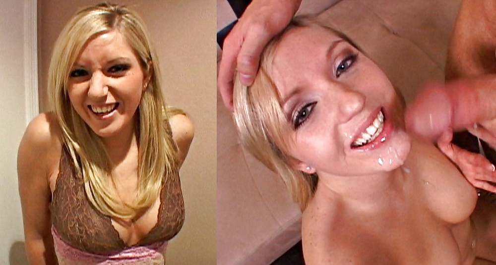 Antes y después de faciales
 #34695851