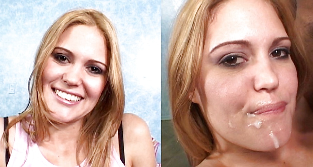 Antes y después de faciales
 #34695877