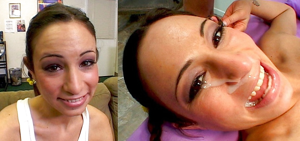 Before-After Facials #34695906