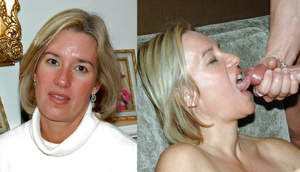 Before-After Facials #34695984