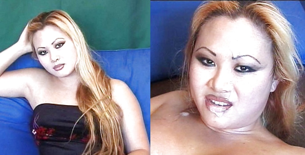 Antes y después de faciales
 #34696043