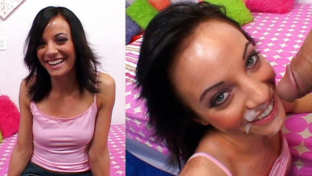 Antes y después de faciales
 #34696072