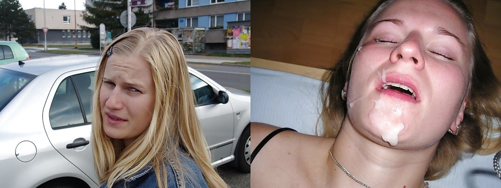 Antes y después de faciales
 #34696079