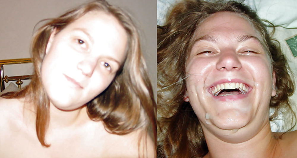 Antes y después de faciales
 #34696089
