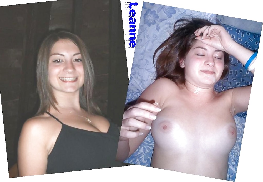 Antes y después de faciales
 #34696099