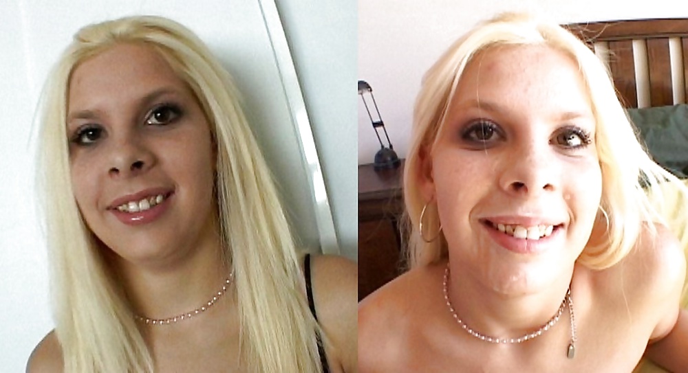 Antes y después de faciales
 #34696108