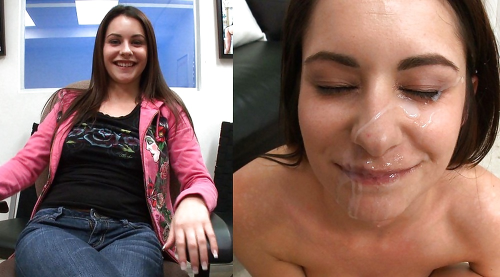 Before-After Facials #34696140