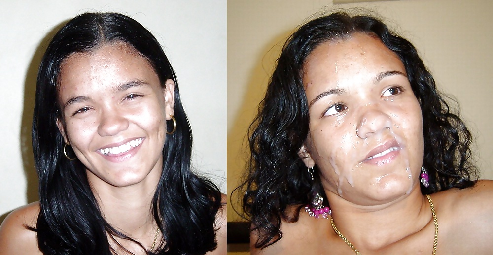 Antes y después de faciales
 #34696157