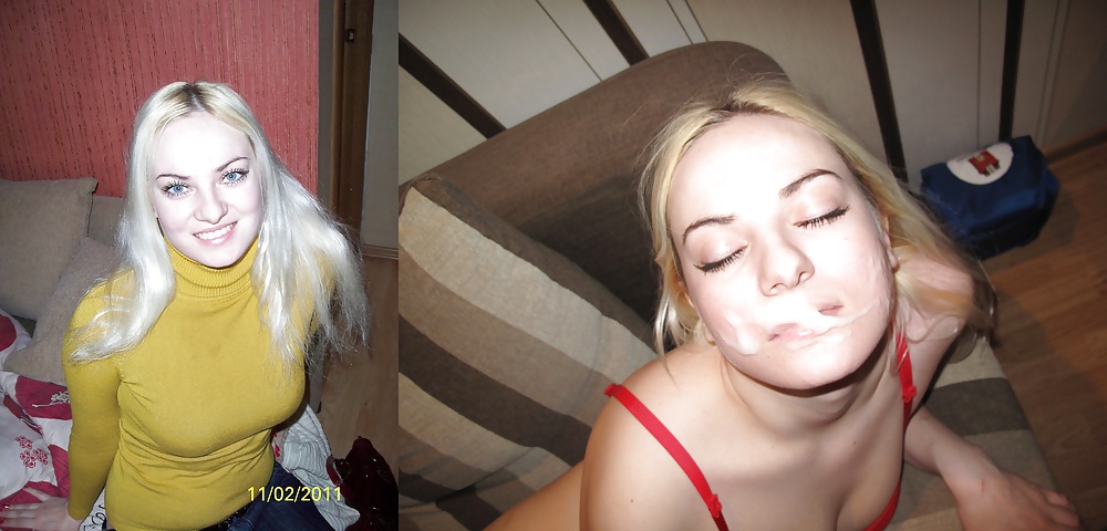 Antes y después de faciales
 #34696182