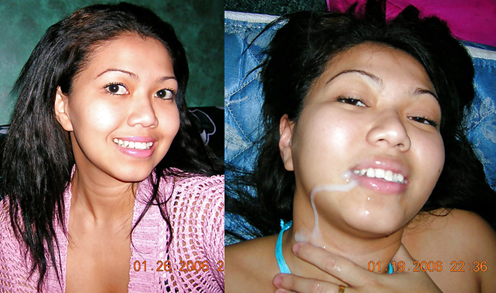 Antes y después de faciales
 #34696226