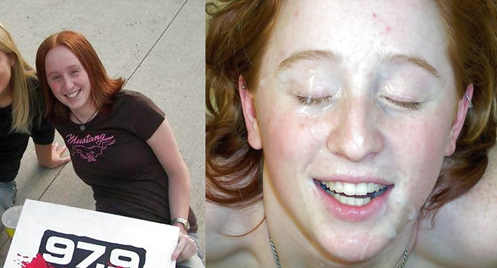 Antes y después de faciales
 #34696279