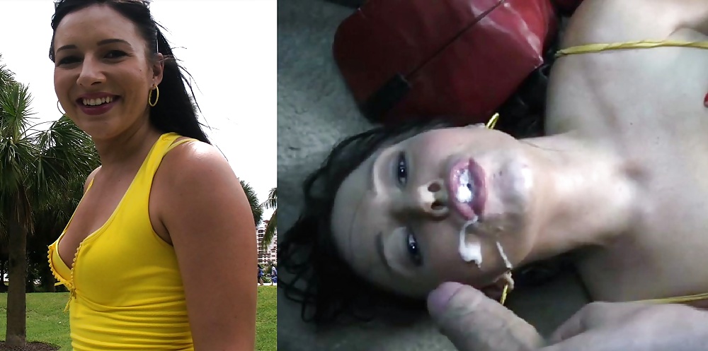 Antes y después de faciales
 #34696283