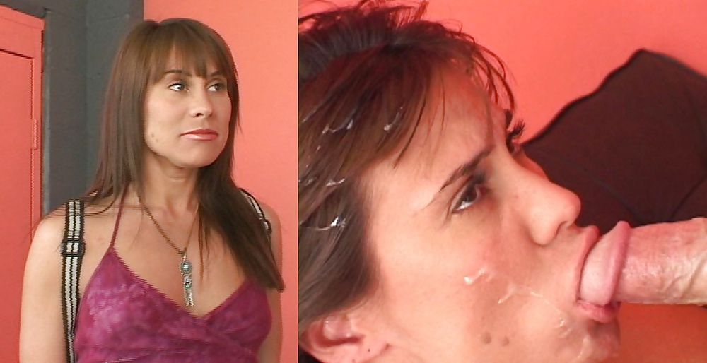 Antes y después de faciales
 #34696299