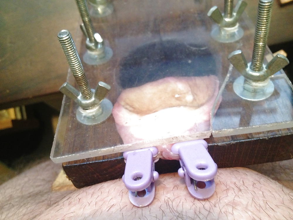 Tons of my self cbt #28264623