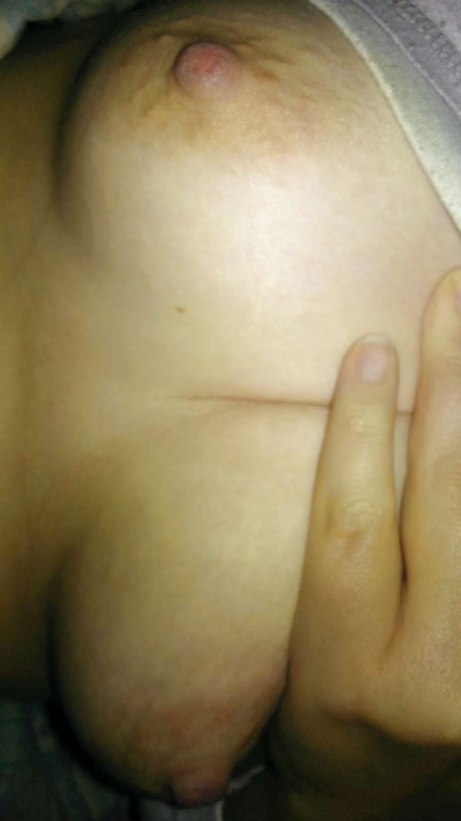Hairy Ex #23334390