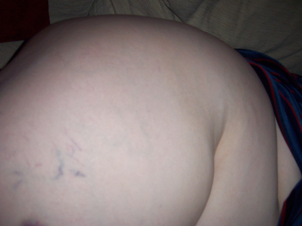 ...more fleshbacks!!!
 #33798457