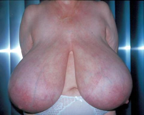 Tetas anormalmente grandes con enormes areolas
 #33362574