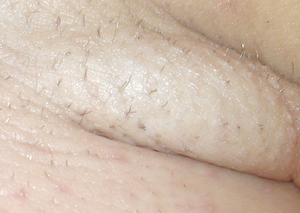 Axila caliente
 #30869304