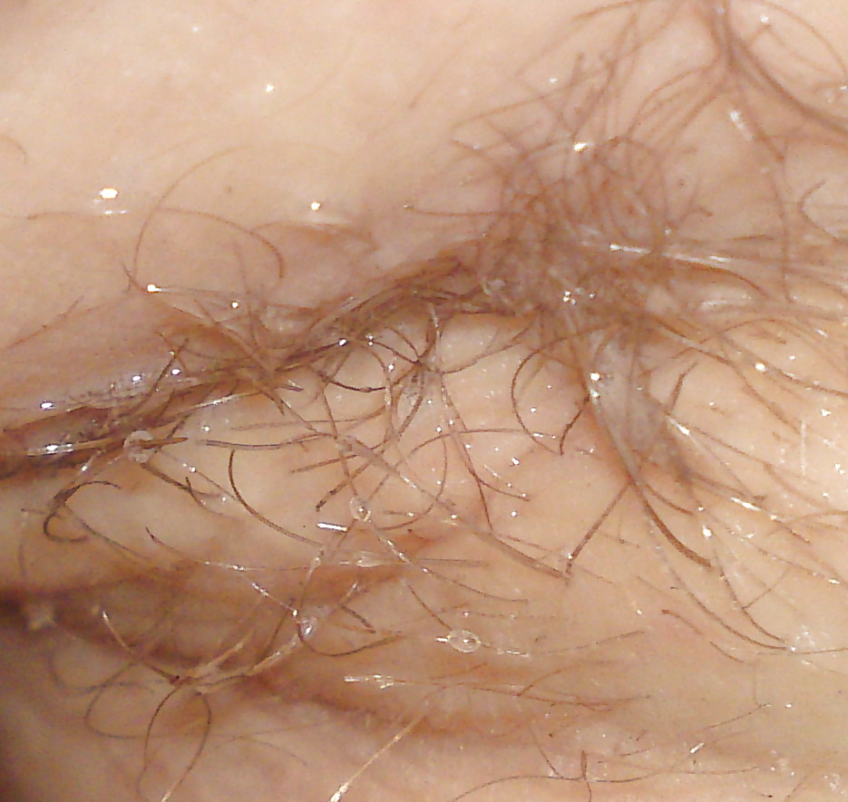 Axila caliente
 #30869347