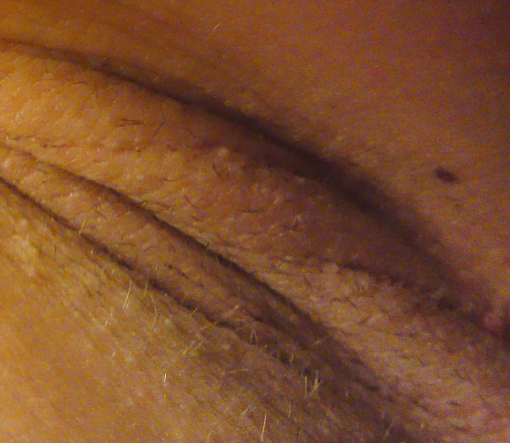 Axila caliente
 #30869392