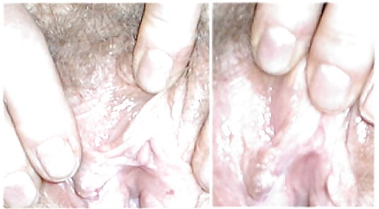 First FTM Internet Images #36501920