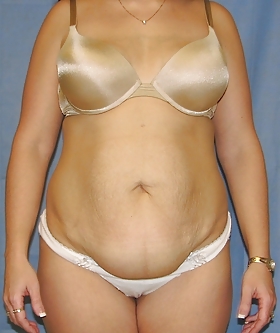 Why change the body part 3 #35900576