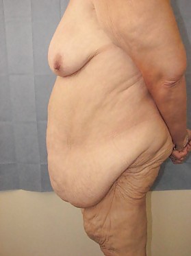 Why change the body part 3 #35900593