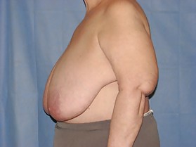 Why change the body part 3 #35900598