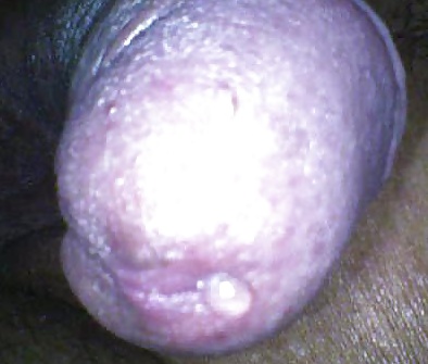 My pole #28597060