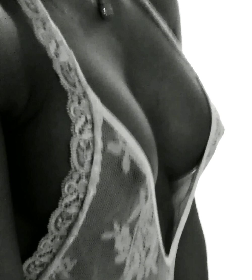 Anetka  #25822533