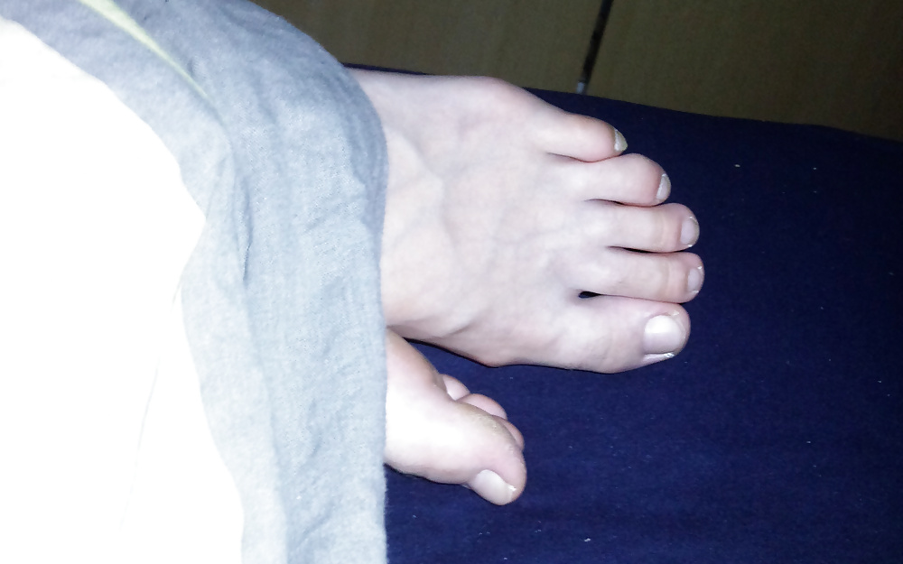 Ronja 's pies - modelo de pie con los pies venosos y suelas lisas
 #28062784