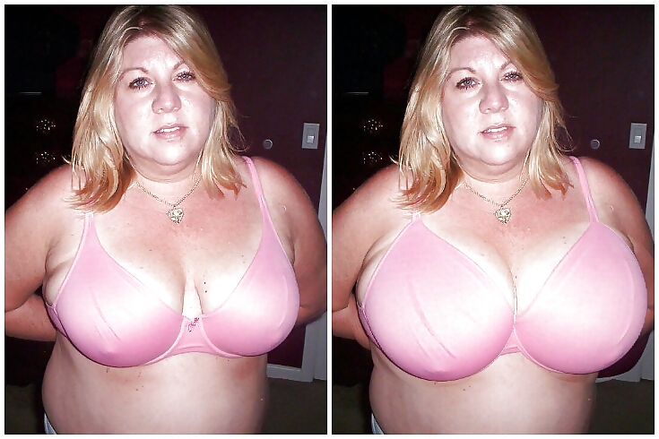 Boob jobs before and after made bigger and better #36635506