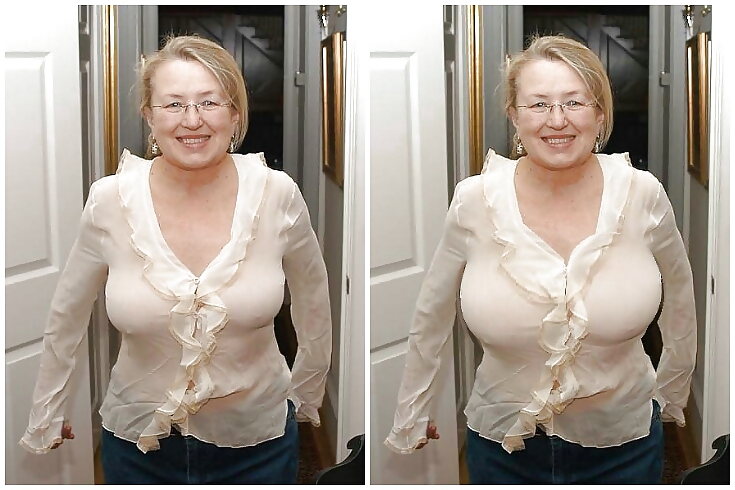 Boob jobs before and after made bigger and better #36635513