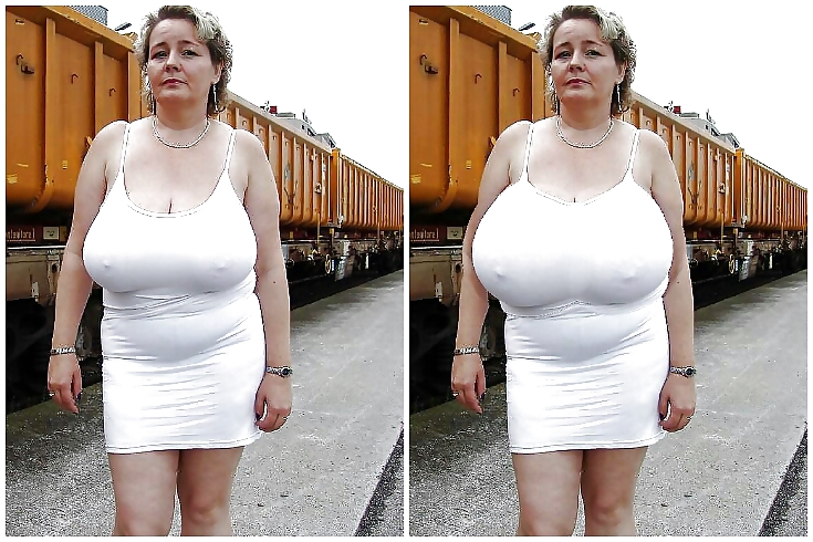 Boob jobs before and after made bigger and better #36635519