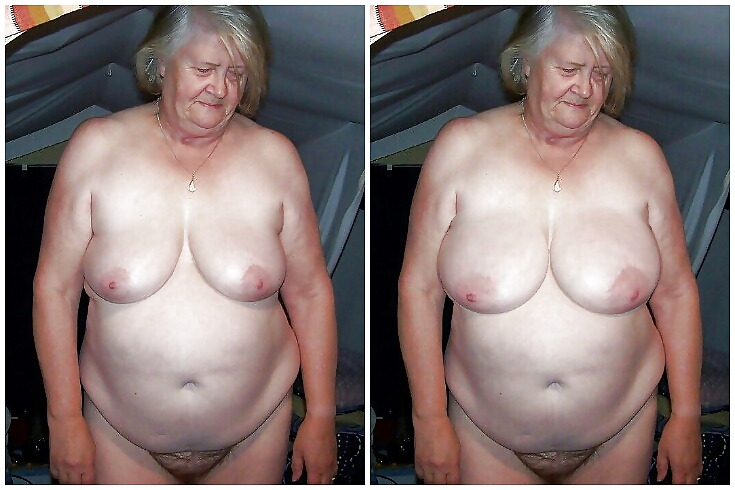 Boob jobs before and after made bigger and better #36635525