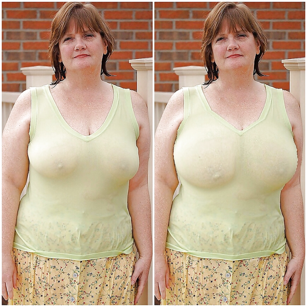 Boob jobs before and after made bigger and better #36635541