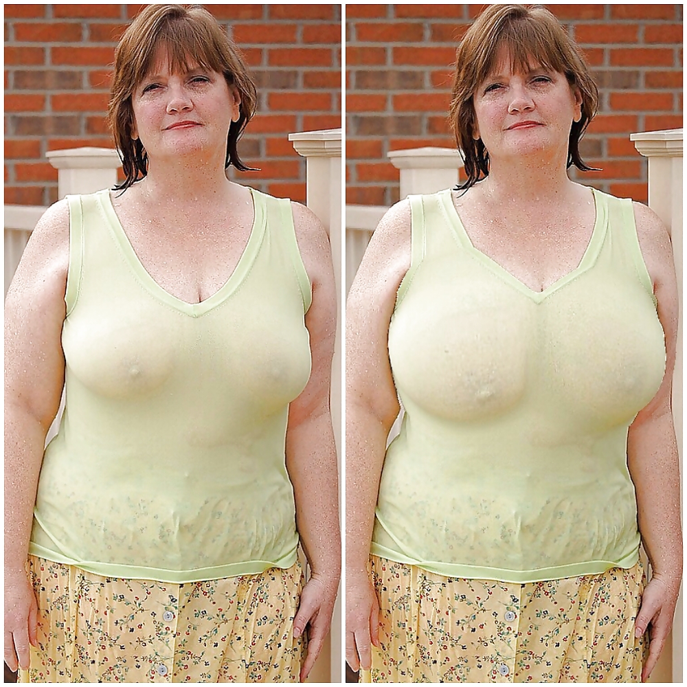 Boob jobs before and after made bigger and better #36635541