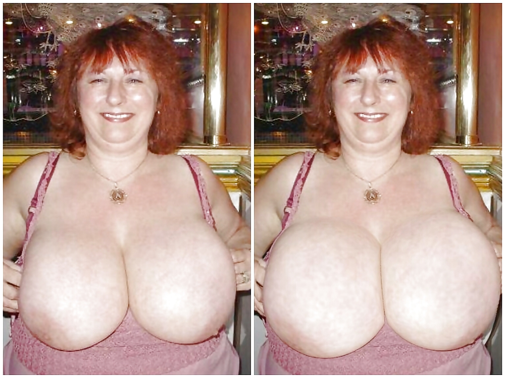 Boob jobs before and after made bigger and better #36635544