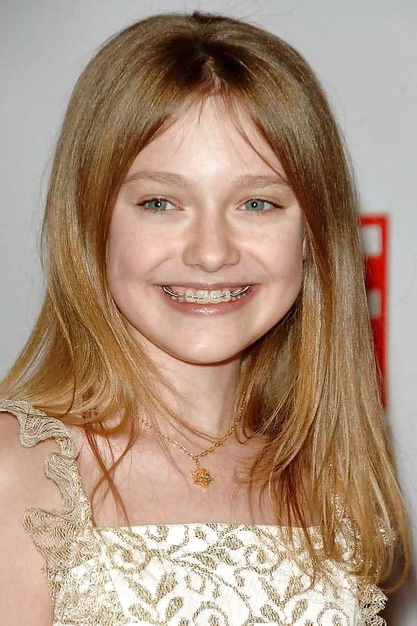 歯列矯正をしている女の子たち 1
 #24604437