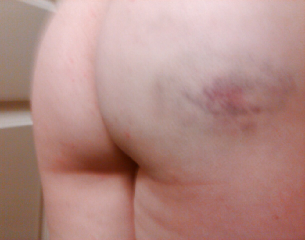 My ass after my birthday spanking #39309387