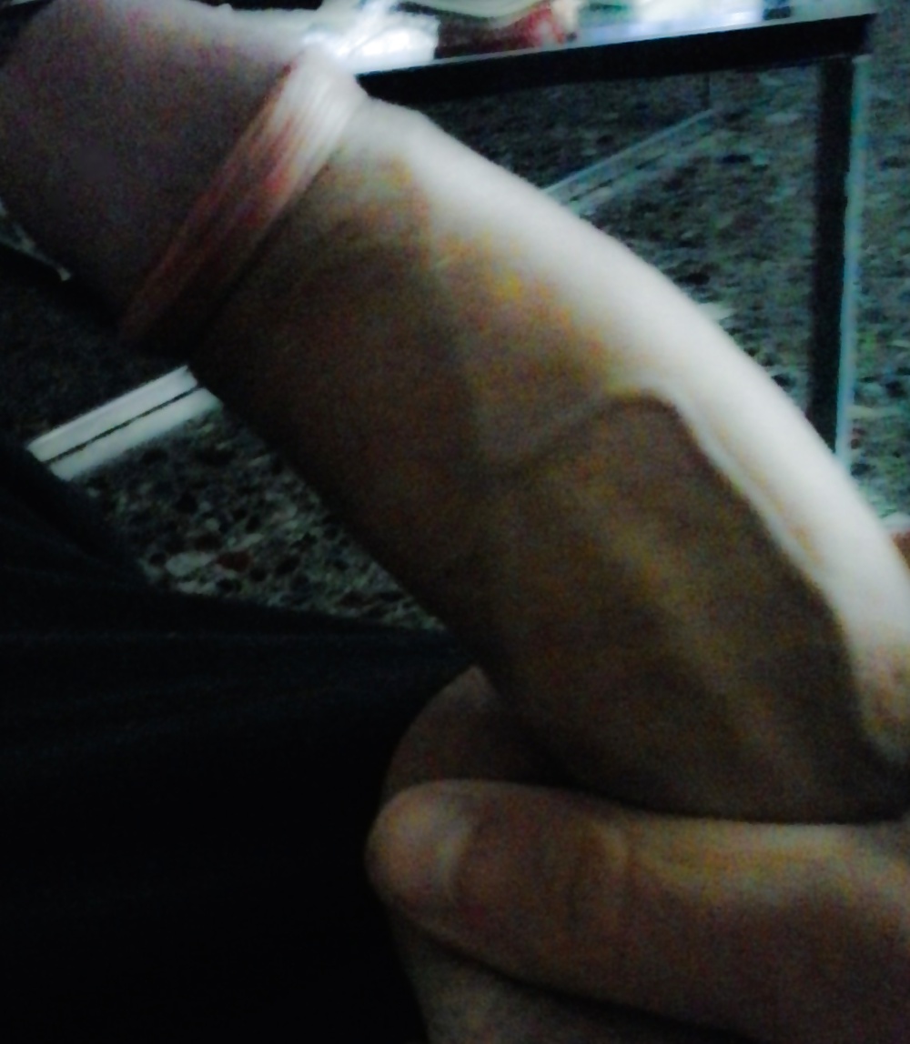 Treles kaules #33274473