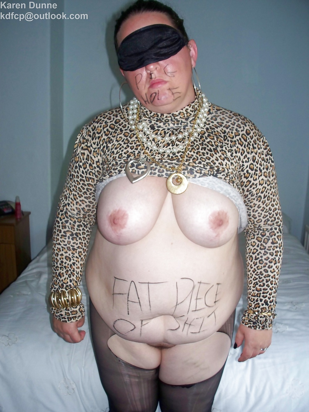 Fat Chav Slut Karen Dunne Exposed #31662038