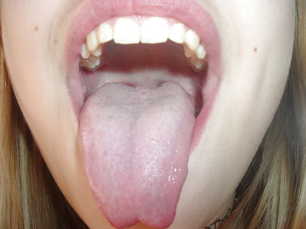 Boca abierta y lengua afuera lista para la corrida
 #40095207