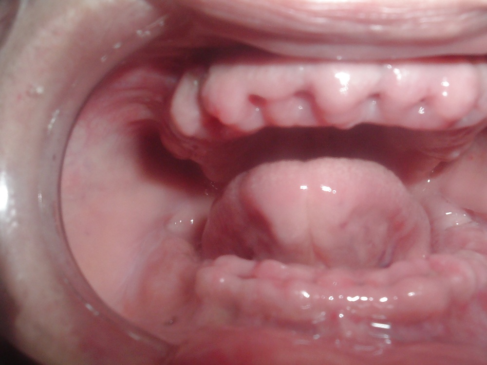 Orale modifikation
 #40355610