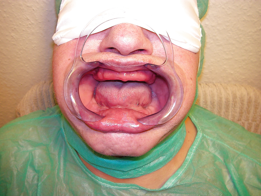 Orale modifikation
 #40355635