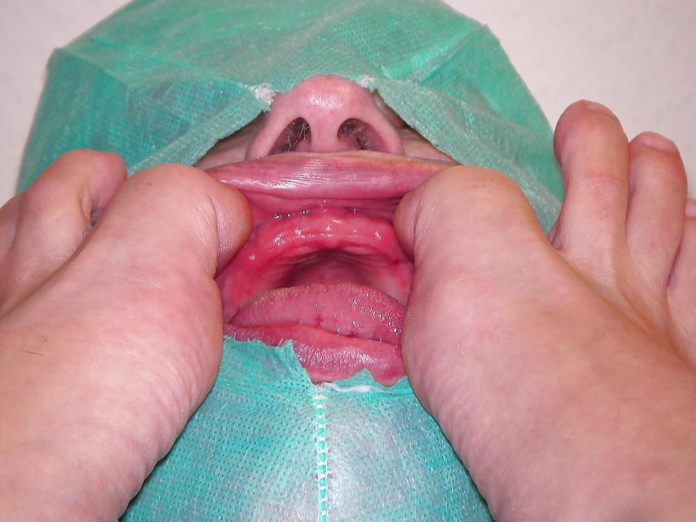 Orale modifikation
 #40355648