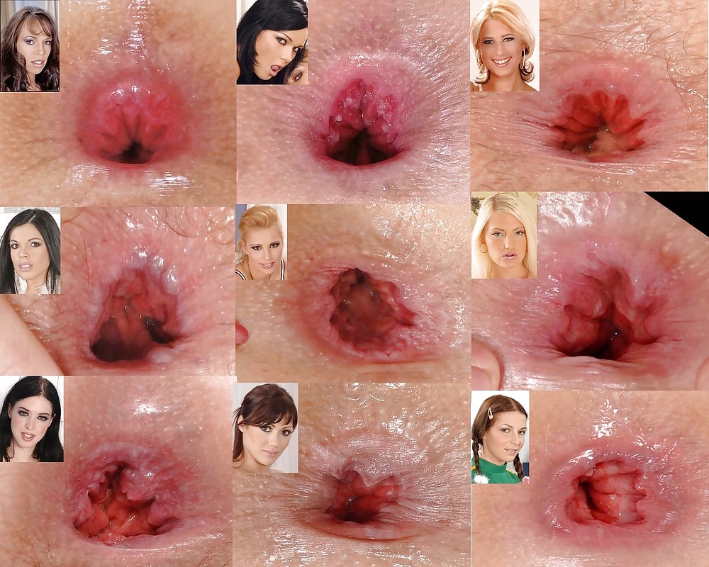 Analized Asses - Part 26 #35036823