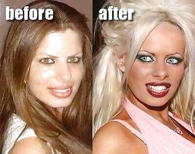 Thanks God for the plastic surgery  #27855606