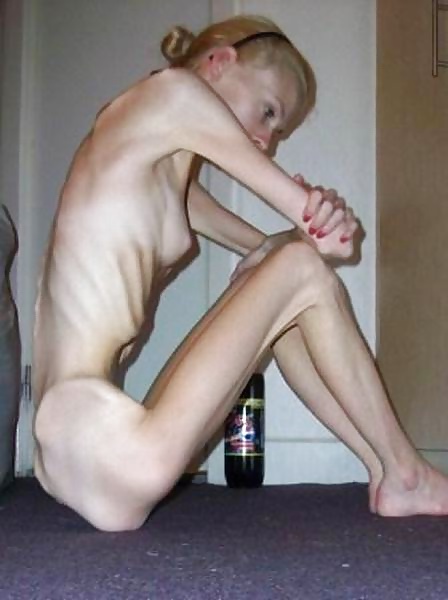 Anorexic Girls #31652602