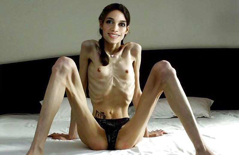 Anorexic Girls #31652607
